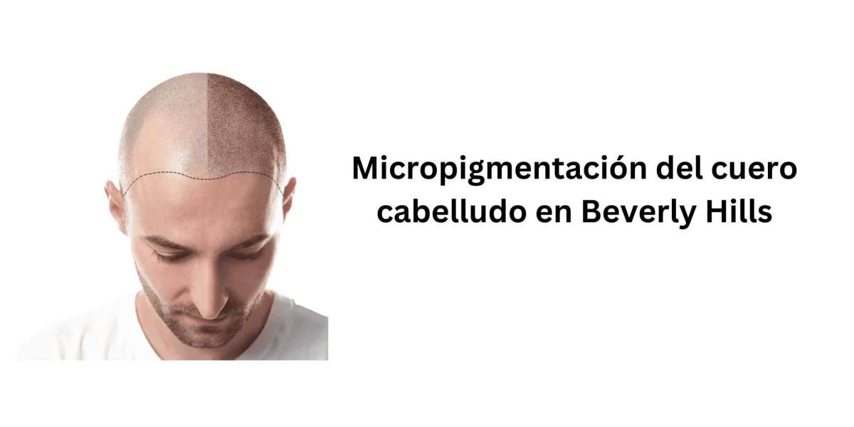 Micropigmentación del cuero cabelludo en Beverly Hills