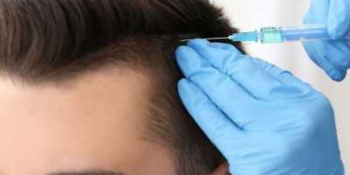 Navigating Hair Transplant Costs in Islamabad: A Comprehensive Guide