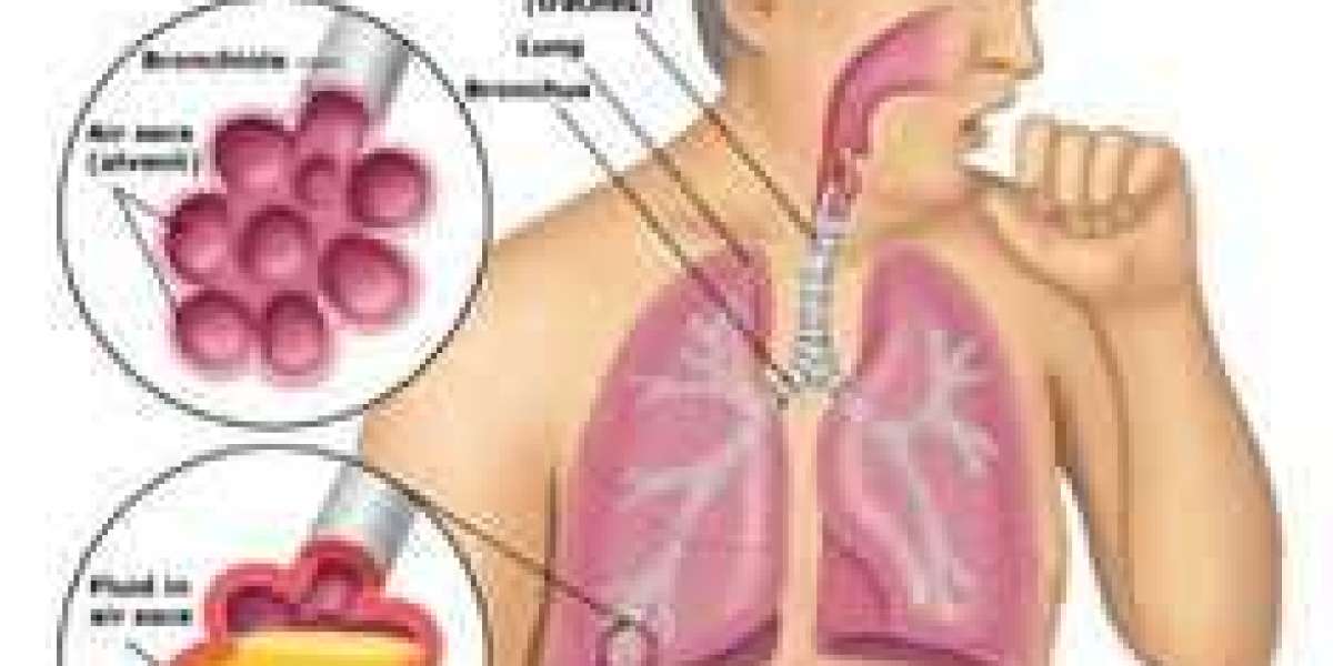 Top 10 Facts About Respiratory Tract Infections