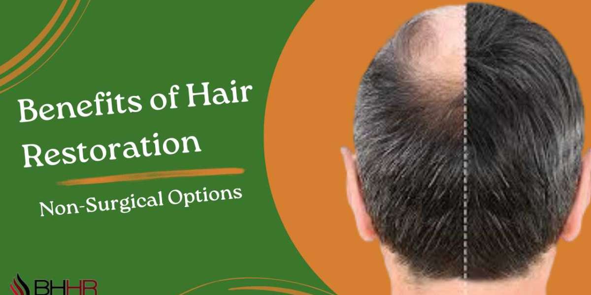 Benefits of Hair Restoration Non-Surgical Options