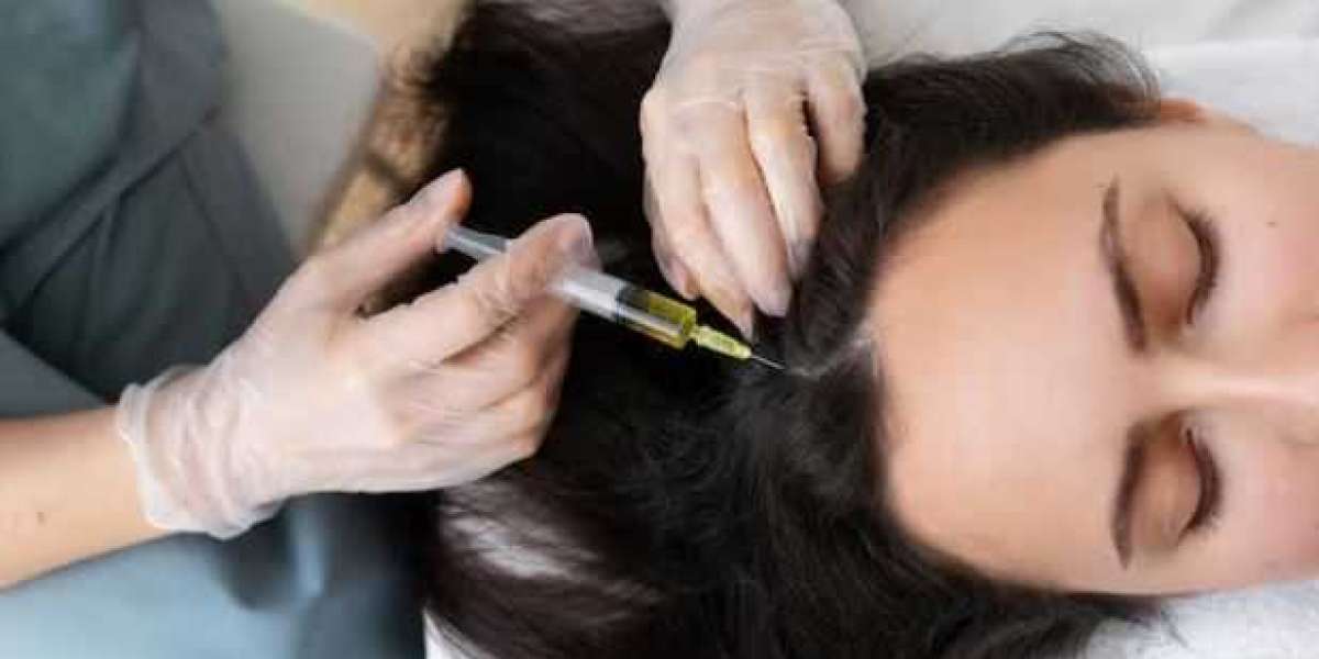 PRP Hair Treatment in Dubai: A Comprehensive Guide to Restoring Your Hair Naturally