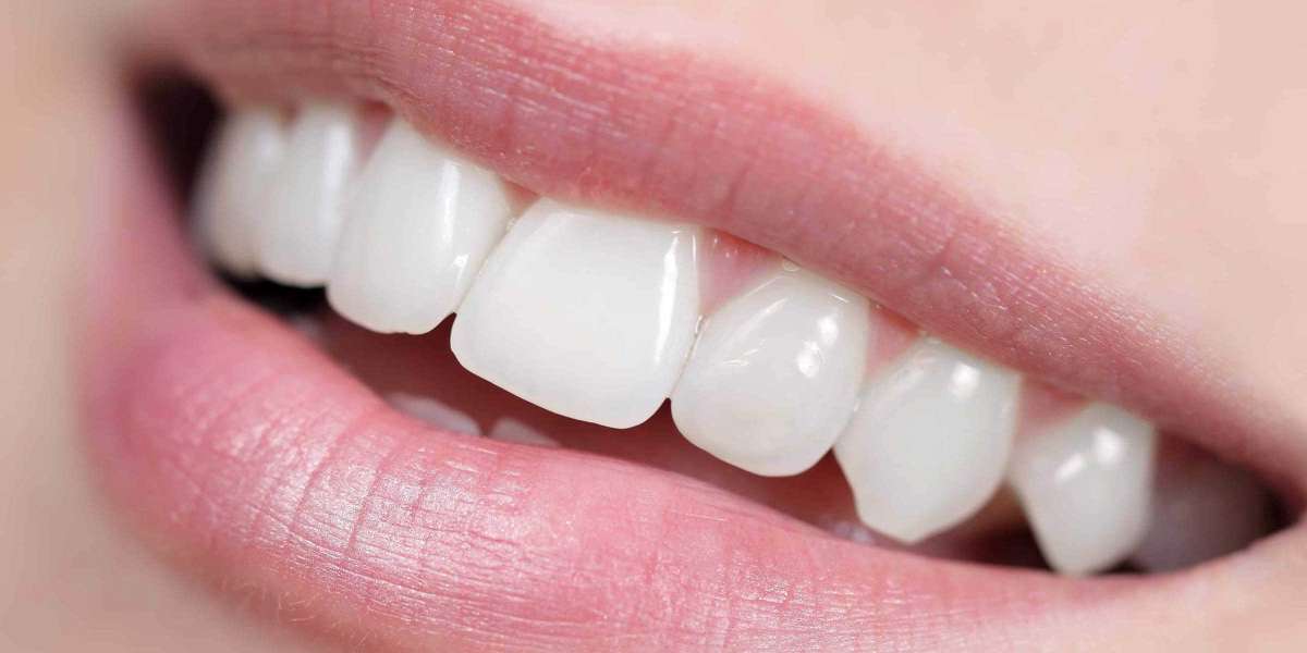 Why Invisalign Dentists in Waltham Cross Recommend Dental Implants in Hatfield