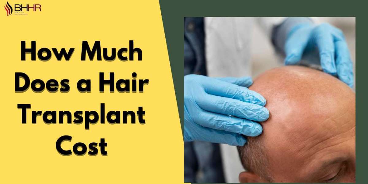 How Much Does a Hair Transplant Cost? Exploring the Price Range