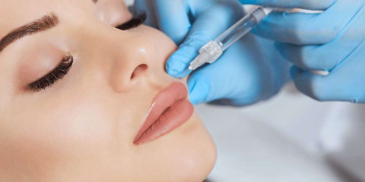 5 Secrets to Stunning Lip Fillers: Insights from Dubai’s Leading Specialists