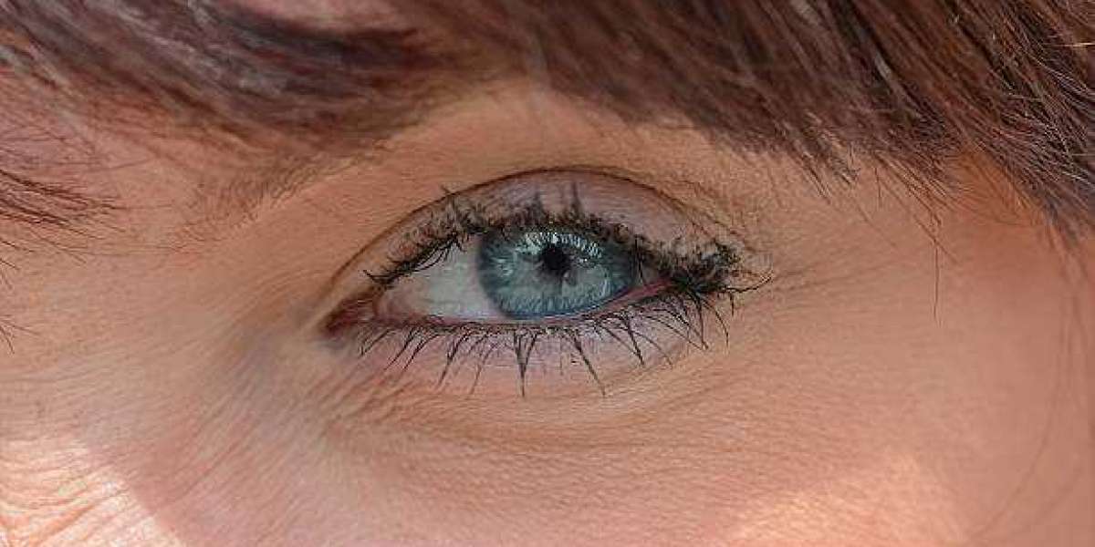 Revitalize Your Eyes with Professional Eye Bag Removal in Riyadh