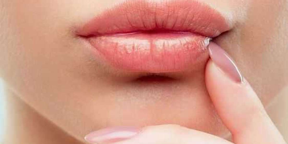 Long-Term Care Tips After Lip Thinning in Riyadh