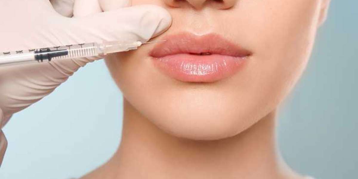 How Lip Fillers Can Boost Your Confidence and Appearance