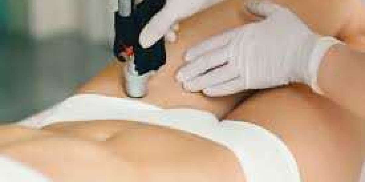 What is Special Treatment in a Med Spa?