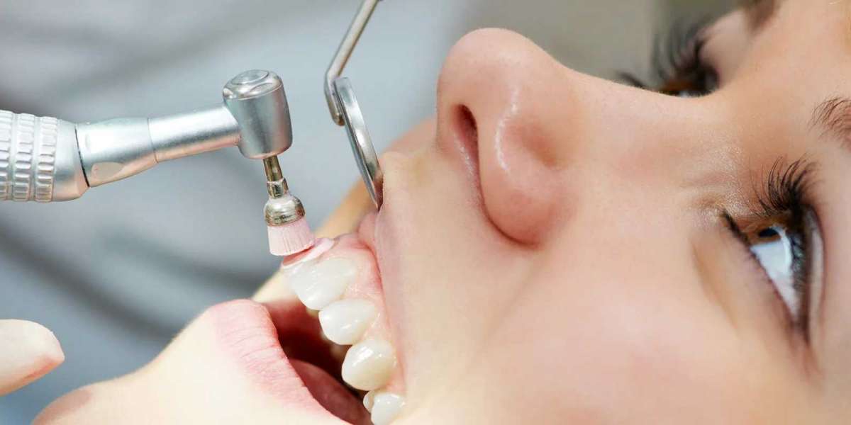 Teeth Scaling in Islamabad: A Game-Changer for Fresh Breath