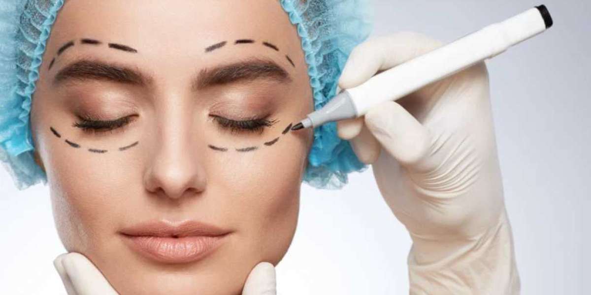 Eyelid Surgery in Islamabad: Procedure Overview and Benefits