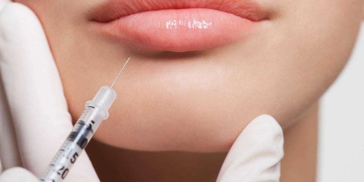 The Price of Beauty: Lip Fillers Explained