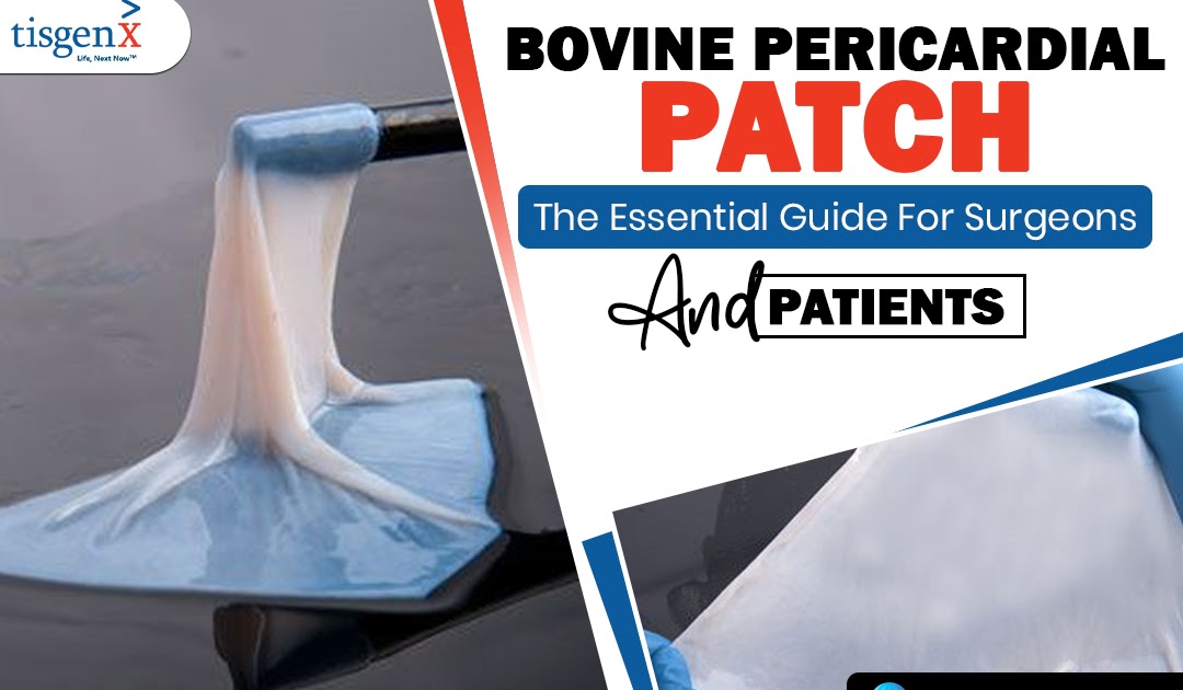 Bovine Pericardial Patch: The Essential Guide For Surgeons And Patients