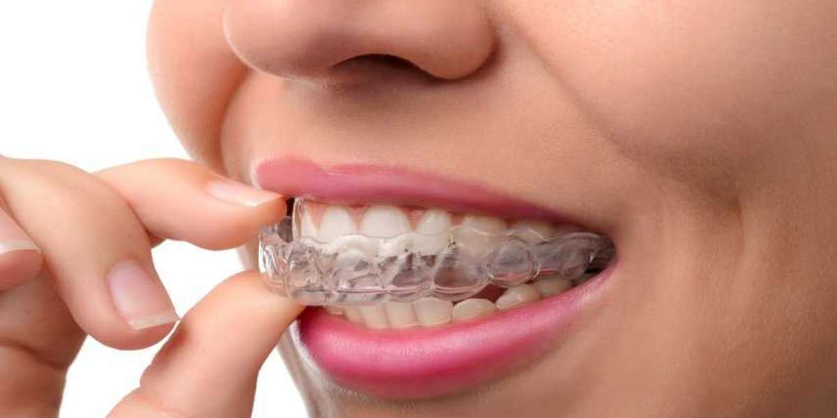 What happens if you don't wear your aligners enough?