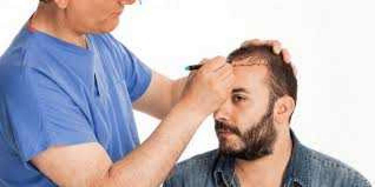 Natural, Permanent, and Painless – Hair Transplants in Riyadh