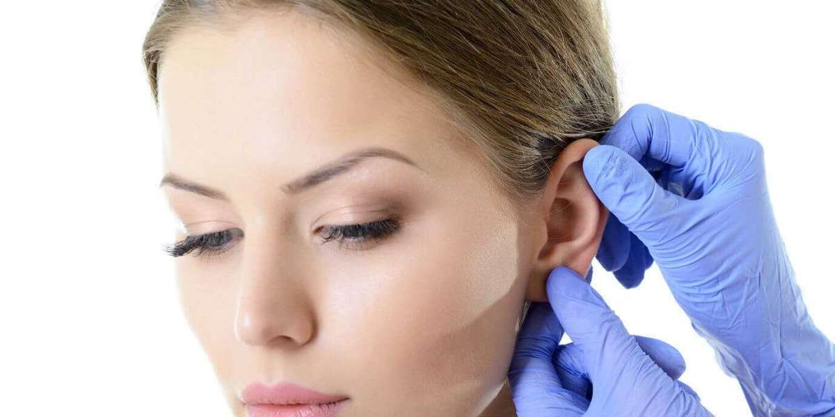 Is Otoplasty in Islamabad Safe? Risks and Benefits Explained