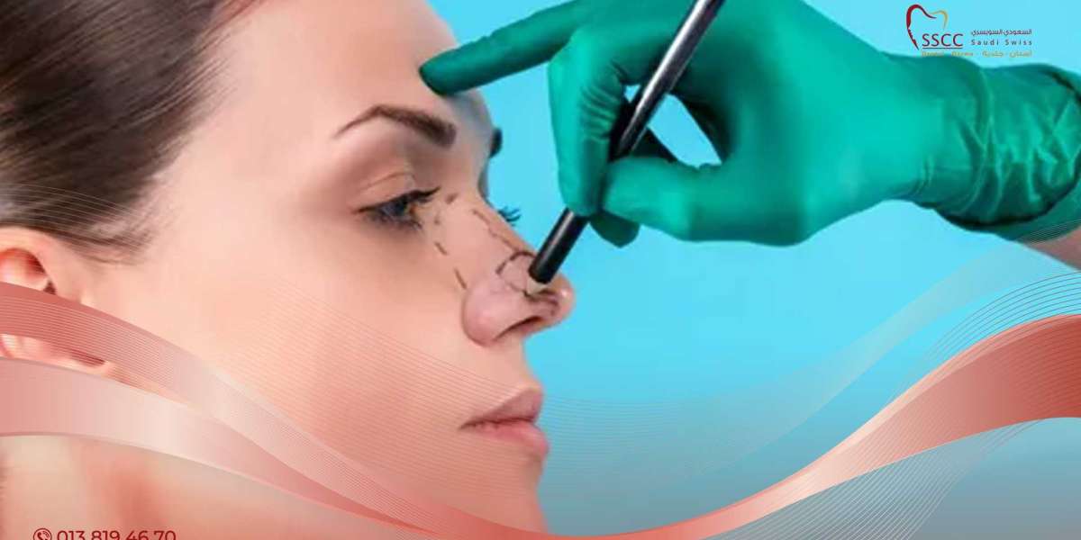 Enhancing Your Profile with Rhinoplasty in Riyadh