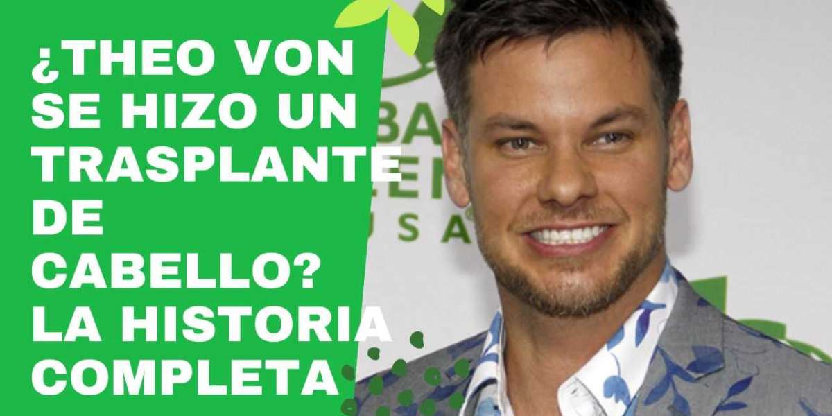 ¿Theo Von se hizo un trasplante de cabello? La historia completa