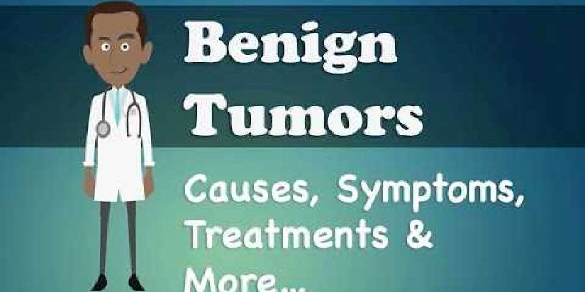 Understanding Benign Tumor Treatment for Congested Pelvic: A Comprehensive Guide