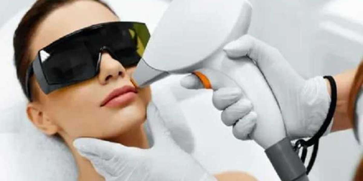 Laser Hair Removal in Riyadh: A Revolutionary Approach to Smooth, Hair-Free Skin