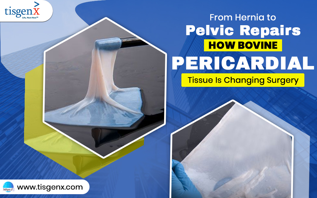 From Hernia to Pelvic Repairs: How Bovine Pericardial Tissue Is Changing Surgery – Tisgenx, Inc