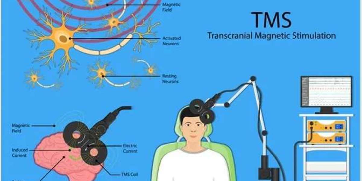 Depression Treatment with TMS